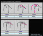 Cusco D1 Chromoly 4 point + Harness Bar Around-Dash AP1 S2000 (does not fit 06+) (S/O / No Cancel)