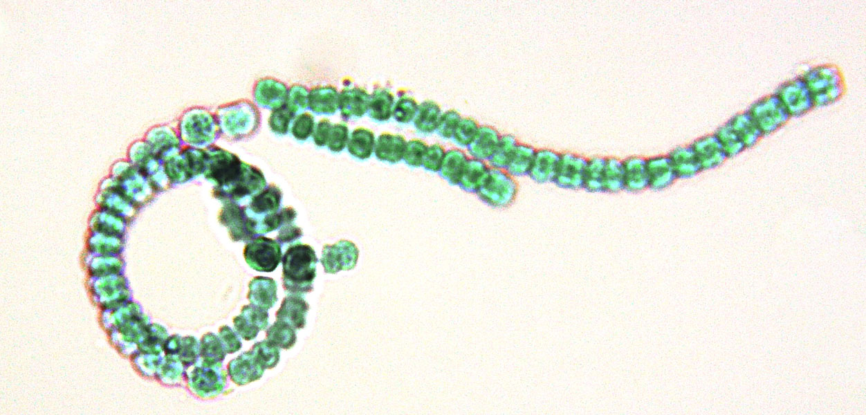 Cyanobacteria - Dolichospermum microscope image