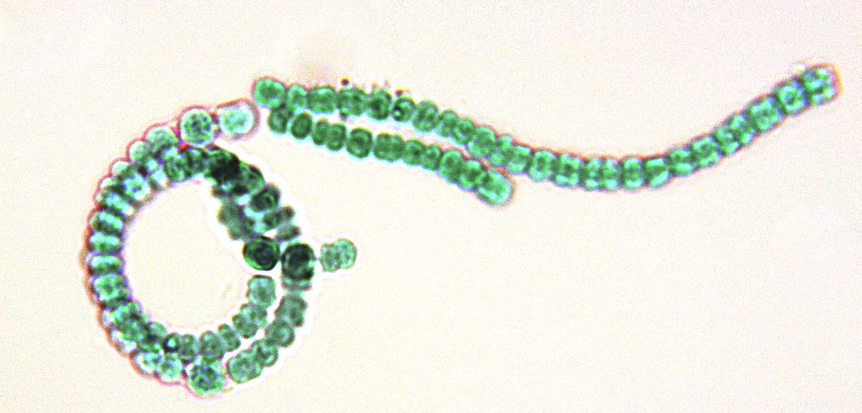 anabaena bacteria