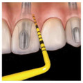 Colorvue Periodontal Probe Promo Kit Single End #6 Yellow  (PCVNCKIT6)