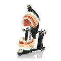 Keystone, 4 Piece Insert For Luxury Articulator, 1050001