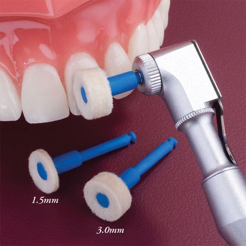 Compo-Blitz Diamond-Impregnated Natural Felt Wheels, Combination Pack - 1.5mm &