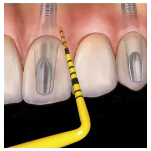 Colorvue Periodontal Probe Promo Kit Single End #6 Yellow  (PCV12KIT6)