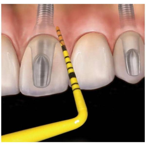 Colorvue Periodontal Probe Promo Kit Single End #6 Yellow Kit (PCVNCKIT12)