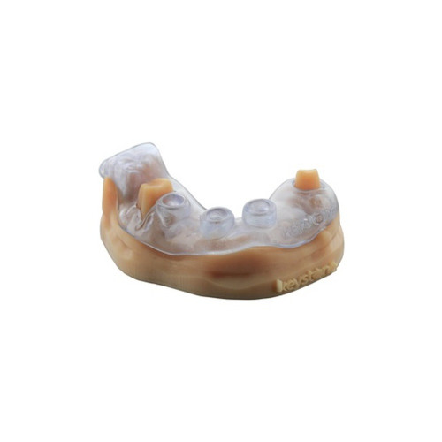 Keystone, Keyguide .5Kg, 4200001