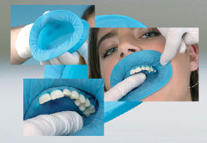 OptraDam Plus Anatomically Shaped Rubber Dam, Assortment Pack. Pack contains