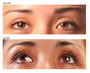 before and after hawrych md lash