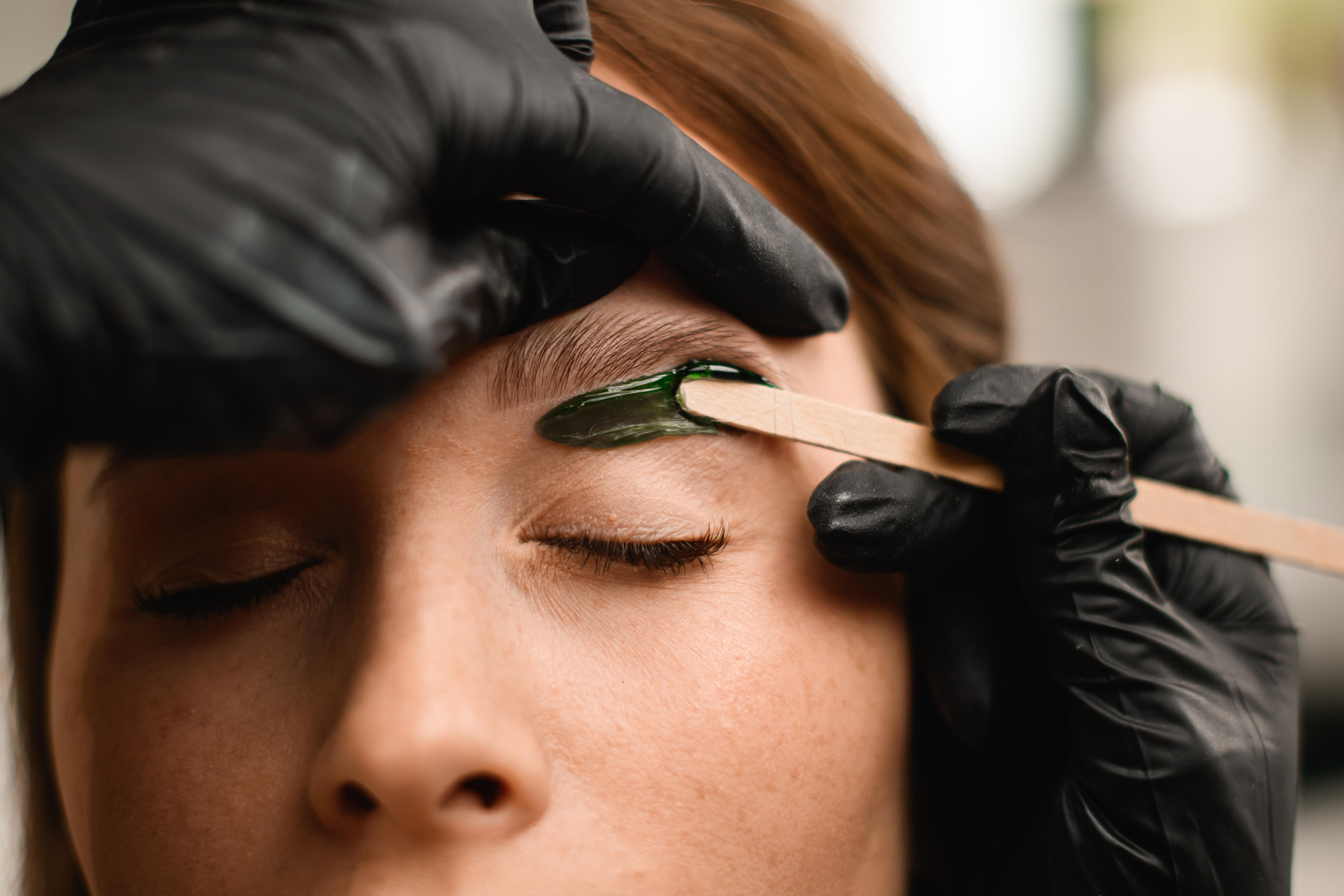 How to Treat Facial Wax Burns