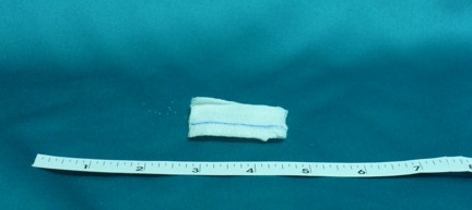 Sponge, Xray Gauze 12ply 2"x2"(10/pk 50pk/cs) Cs - 50