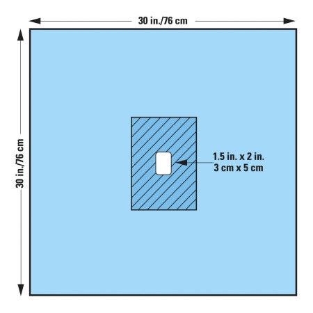Drape, Surg Fenstd 30"x30" (25/pk 4pk/cs) Pk - 25