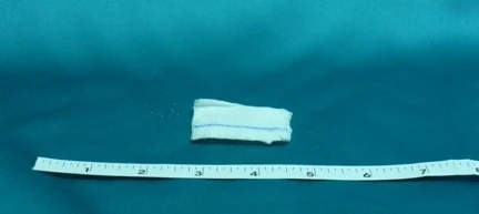Sponge, Xray Gauze 12ply 2"x2"(10/pk 50pk/cs) Cs - 50