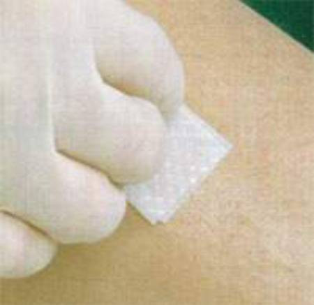 Wipe, Skin Prep No-sting (50/bx 20bx/cs) Bx - 50