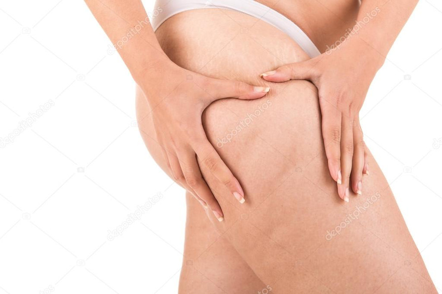 ​Cellulite What is it and what can you do to help eliminate it?