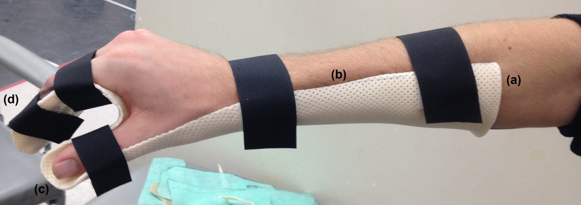 Medical Splints and Supports: Enhancing Patient Care in the Medical Field