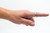AFH swan neck ring splint, stainless steel, circumference 72mm