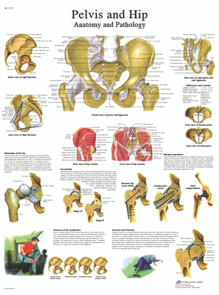 Anatomical Chart - hip & pelvis, paper