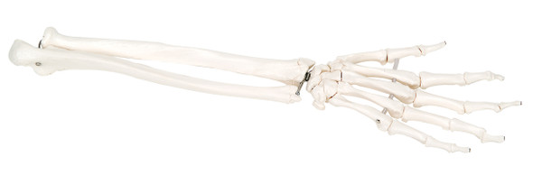 3B Scientific Anatomical Model - loose bones, hand skeleton with ulna and radius, left (bungee) - Includes 3B Smart Anatomy