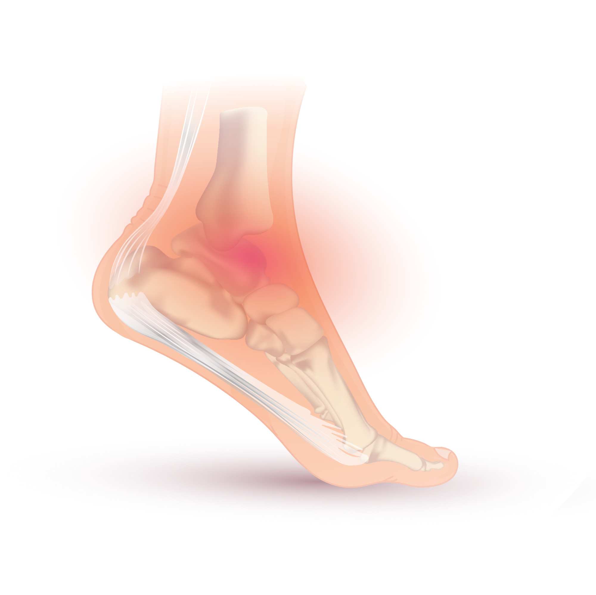 Recurrent Injuries Using Physical Therapy to Treat Recurrent Injuries - Rehab Therapy Supplies