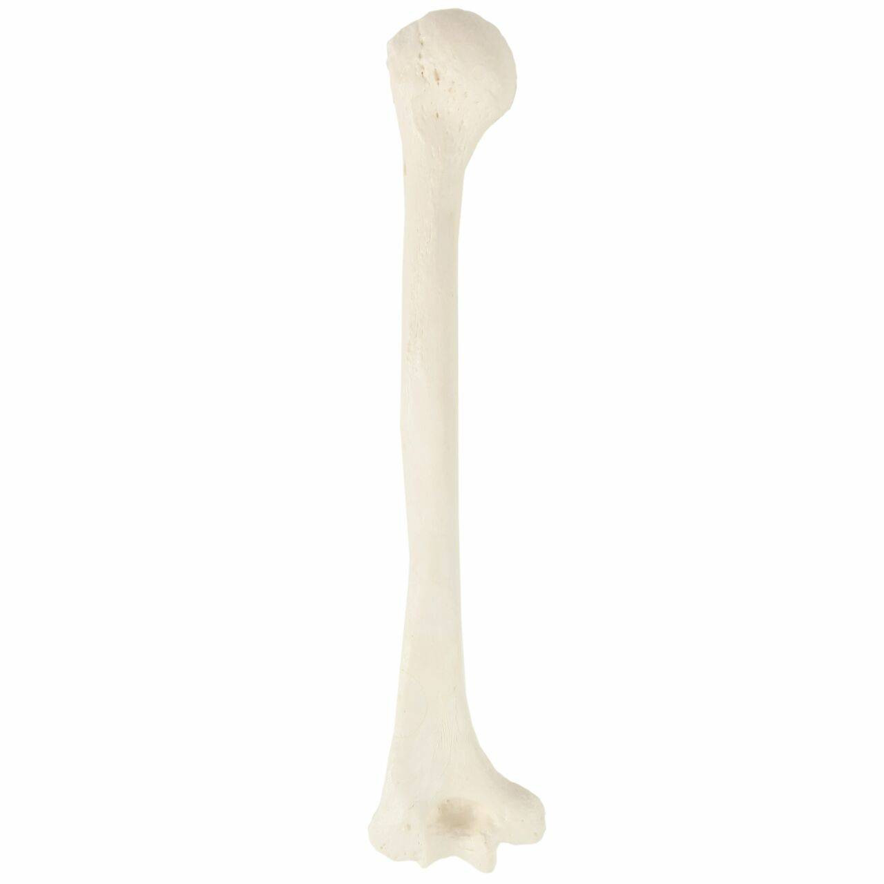 Axis Scientific Humerus Bone