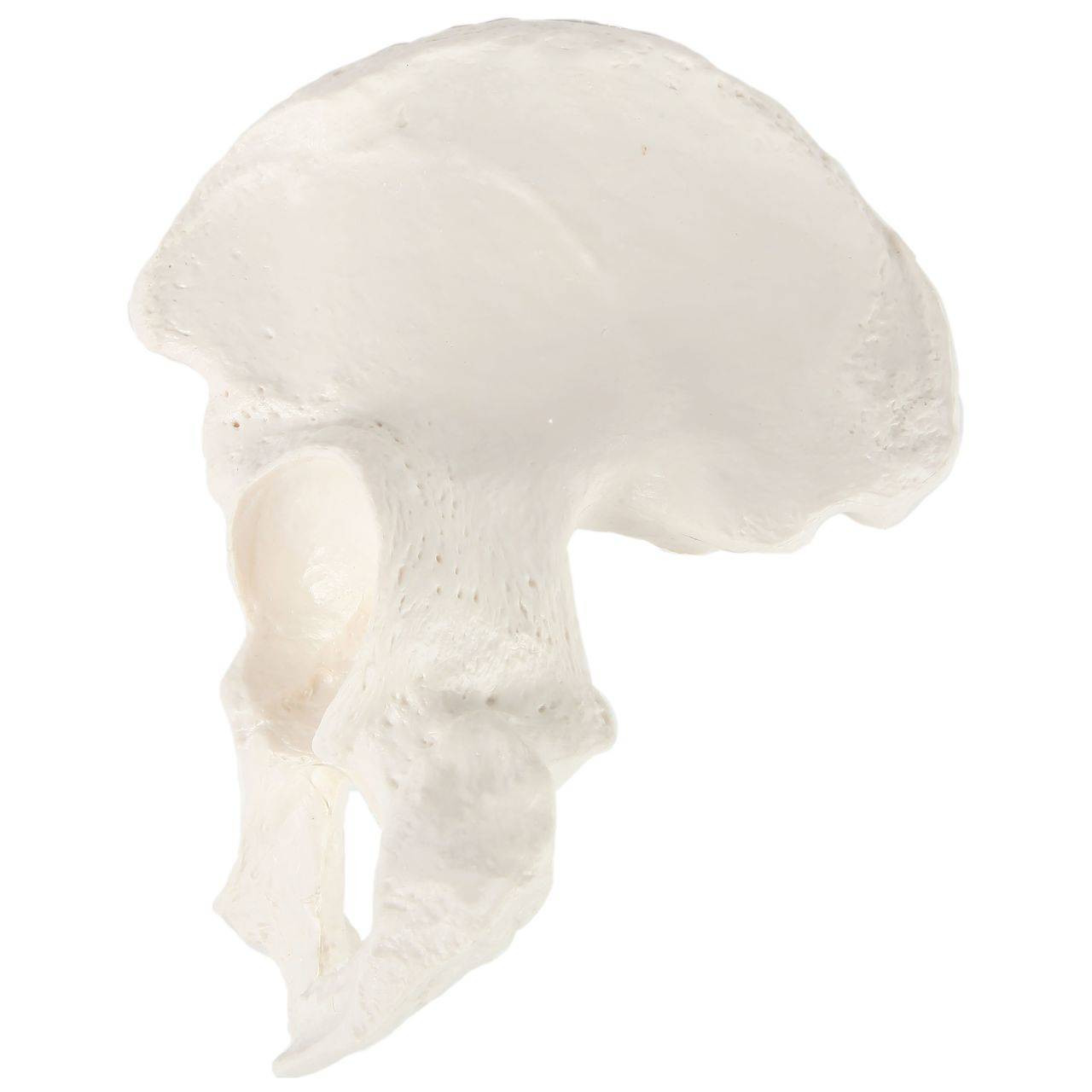 Axis Scientific Hip Bone