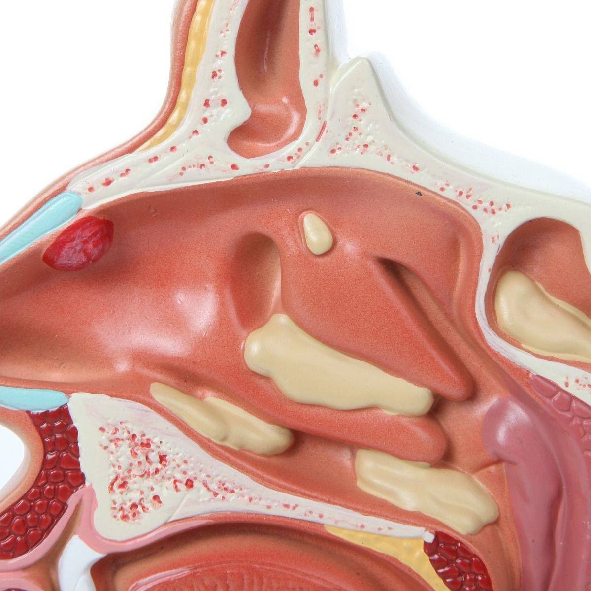 Axis Scientific Larynx and Pharynx Disorders Model