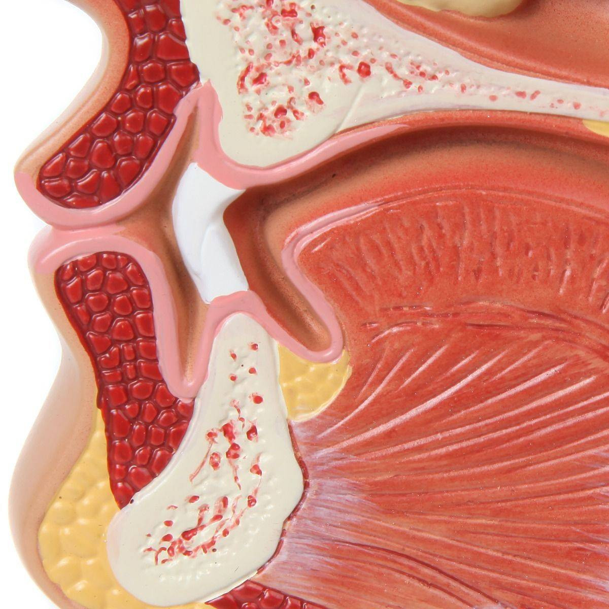 Axis Scientific Larynx and Pharynx Disorders Model