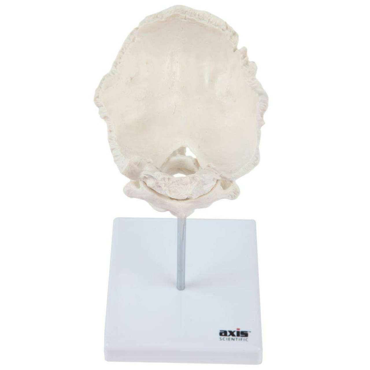 Axis Scientific Occipital Bone - C1 and C2
