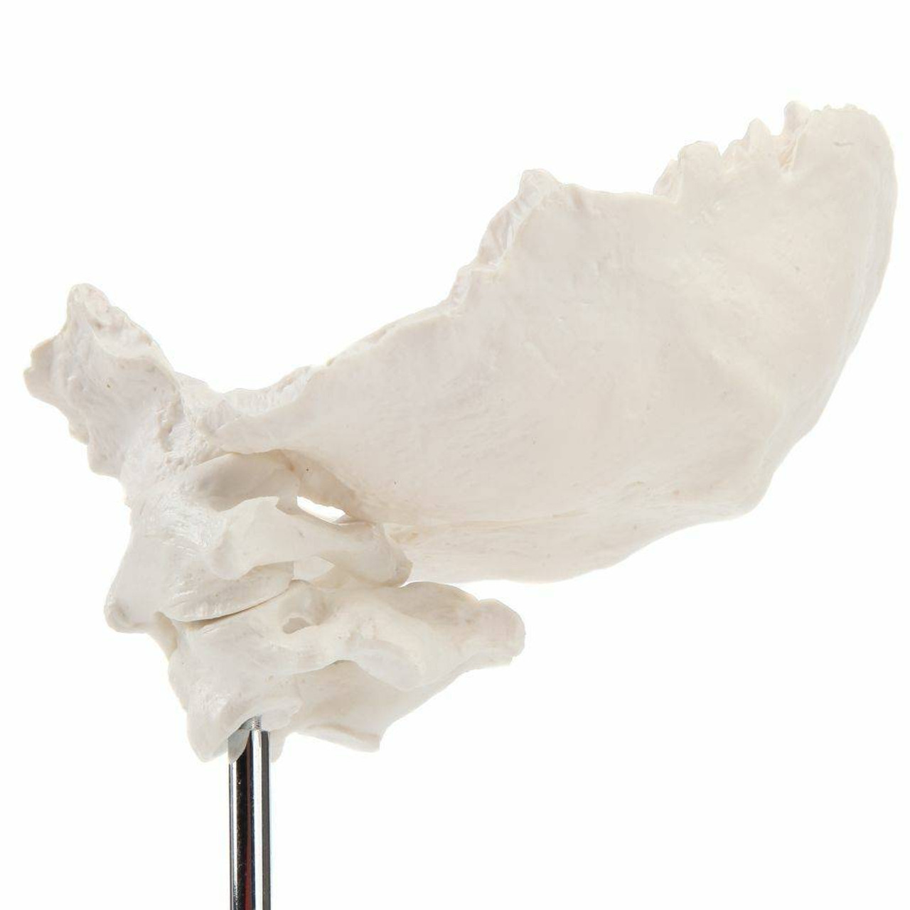 Axis Scientific Occipital Bone - C1 and C2