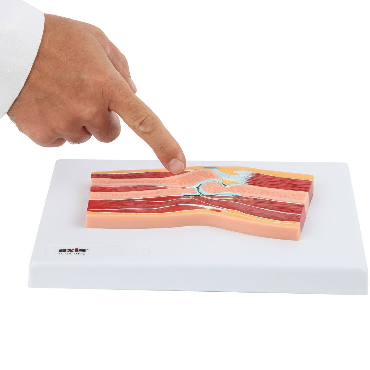 Axis Scientific Elbow Joint Section Anatomy Model