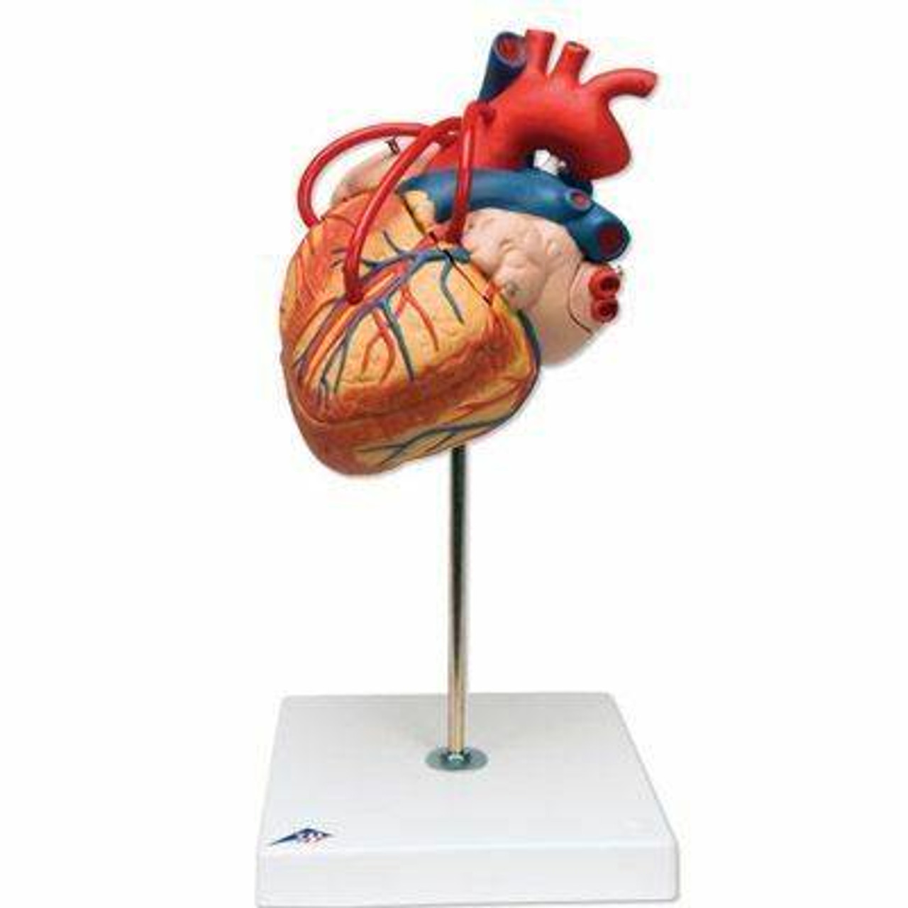 Human Heart Anatomy Model With Bypass