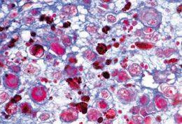 Human Pathology - English Microscope Slides Basic Set