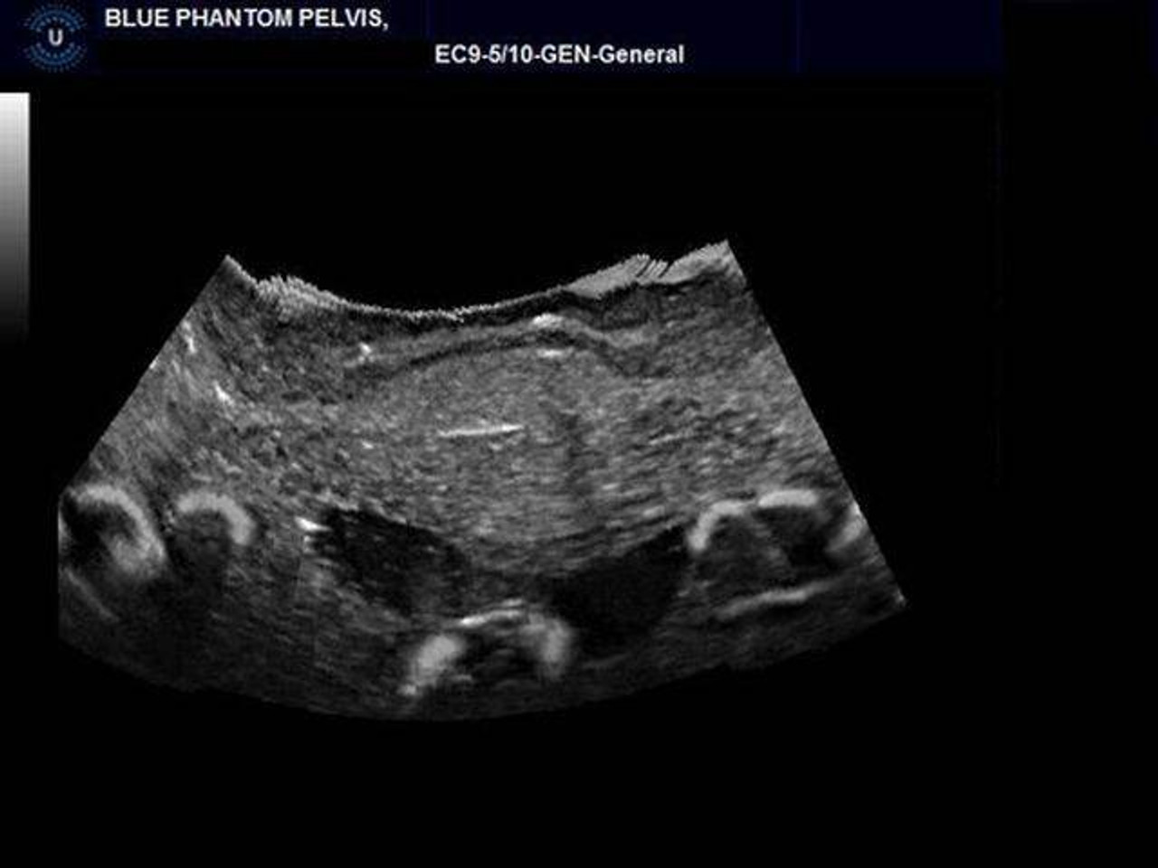 Ectopic Pregnancy Transvaginal Ultrasound Training Model