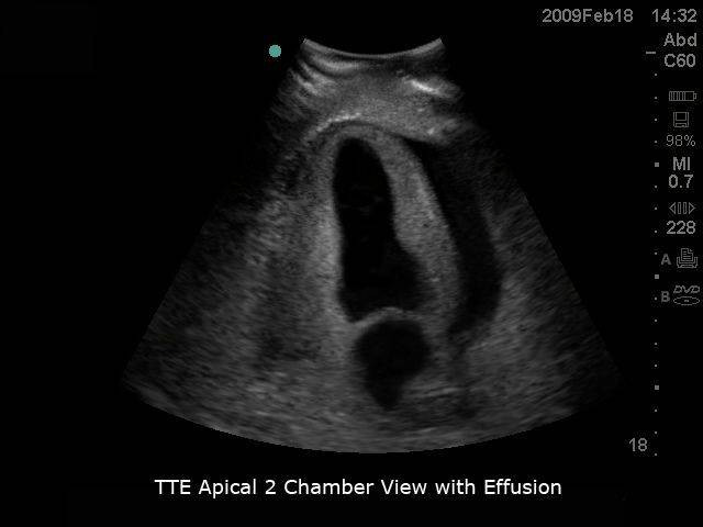 Transthoracic Echocardiography and Pericardiocentesis Ultrasound Training Model