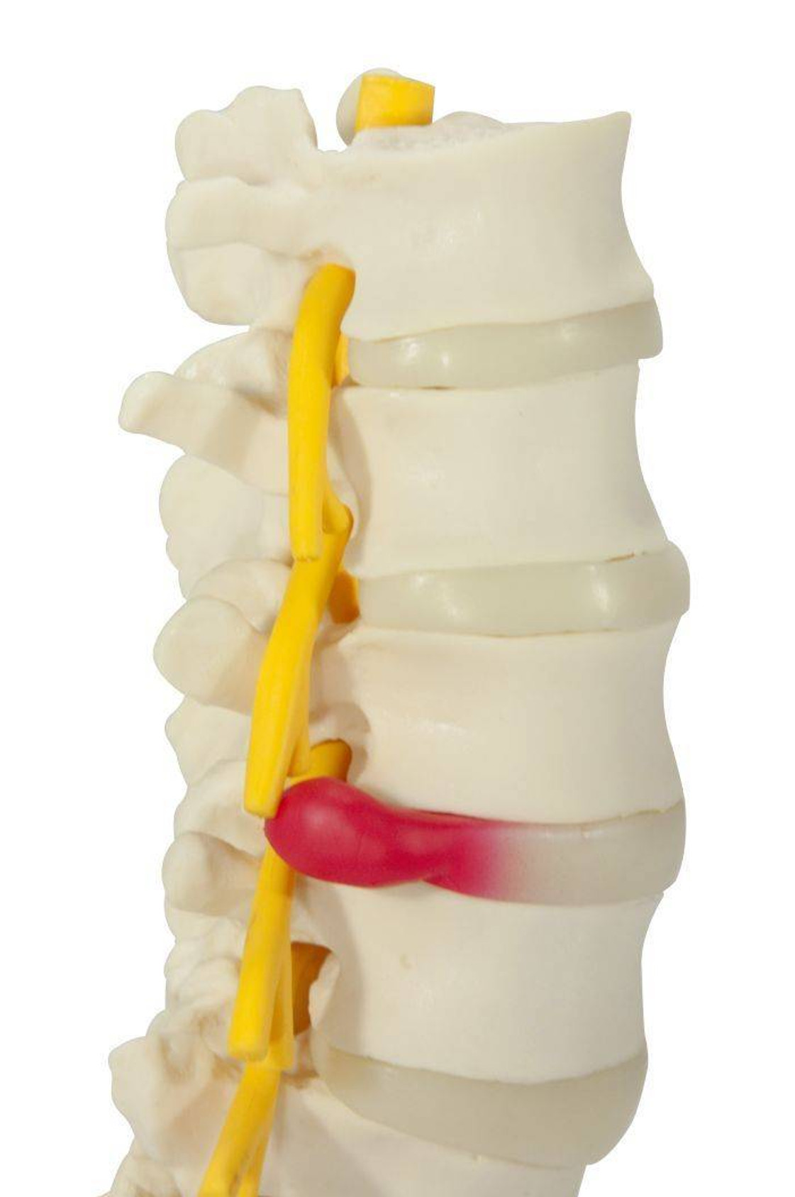5 Piece Vertebral Column Anatomy Model With Sacrum