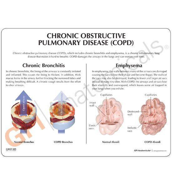 COPD Model with Bronchus and Alveoli
