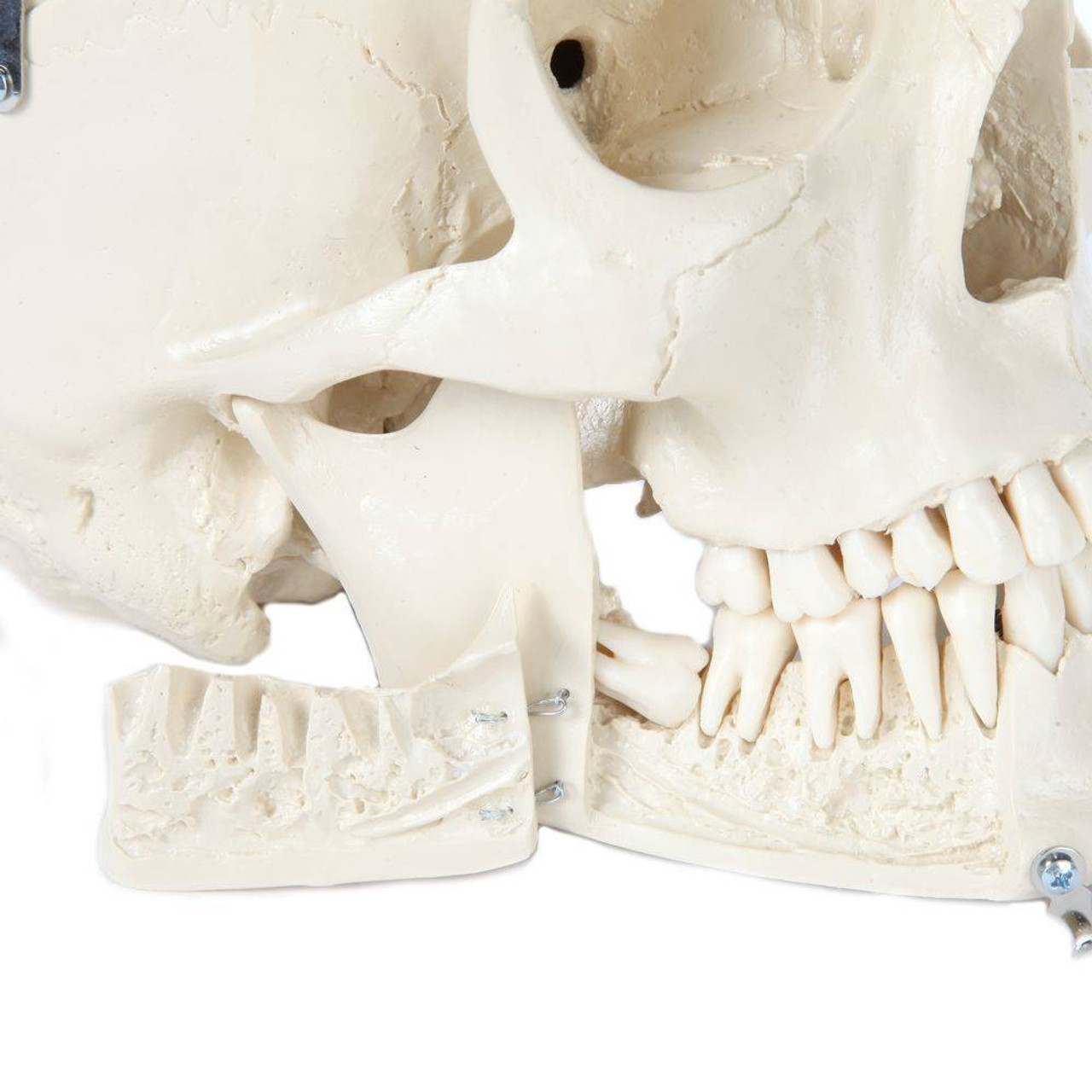 Rudiger Anatomie Premium Complete Disarticulated Skeleton