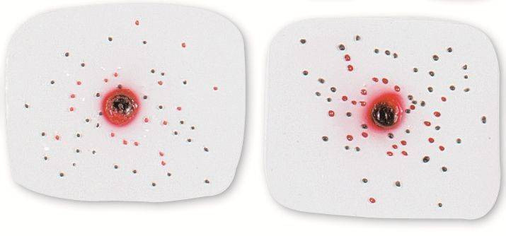 Intermediate Wound Flake Simulator