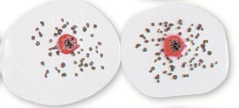 Intermediate Wound Round Simulator