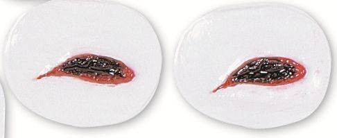 Single Edge Wound Simulator