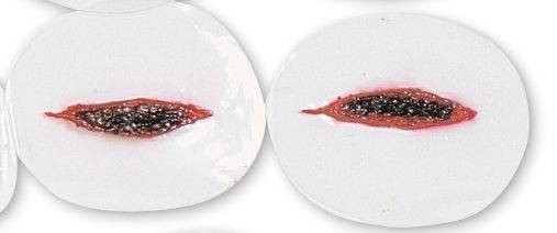 Double Edge Wound Simulator