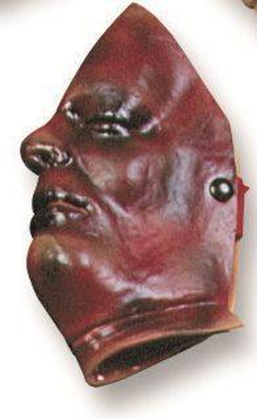 Burn Of The Face Model 2nd and 3rd Degree