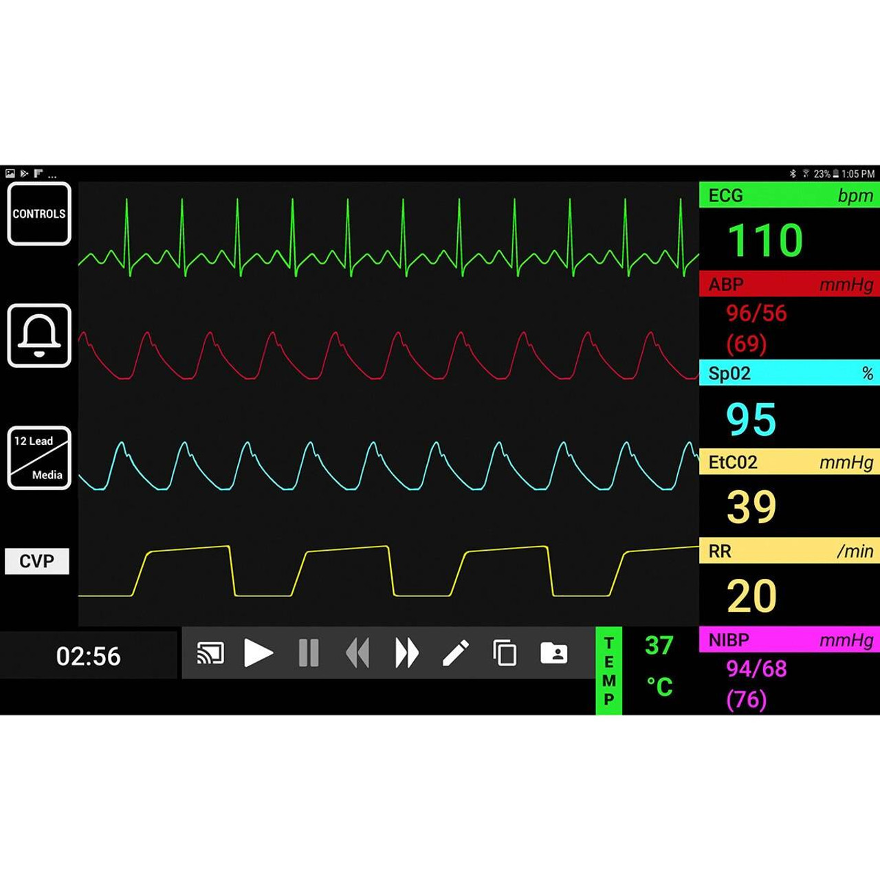 Life/form Advanced Lucy SimVS OB Delivery Simulation System