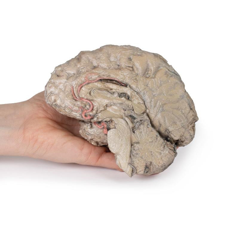 3D Printed Brain Hemisection