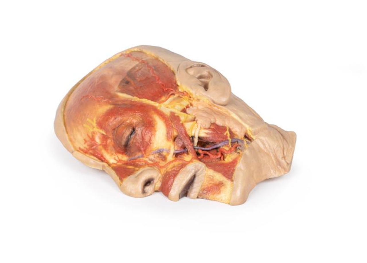 3D Printed Superficial Dissection of the Face