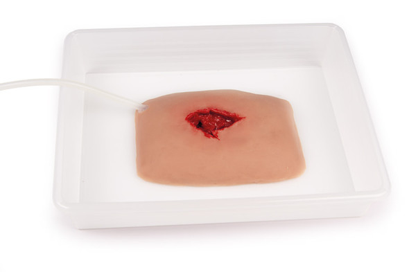 Large Wound Moulage for Wound Packing Large Wound Moulage for Wound Packing