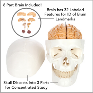 Dissected skull and brain