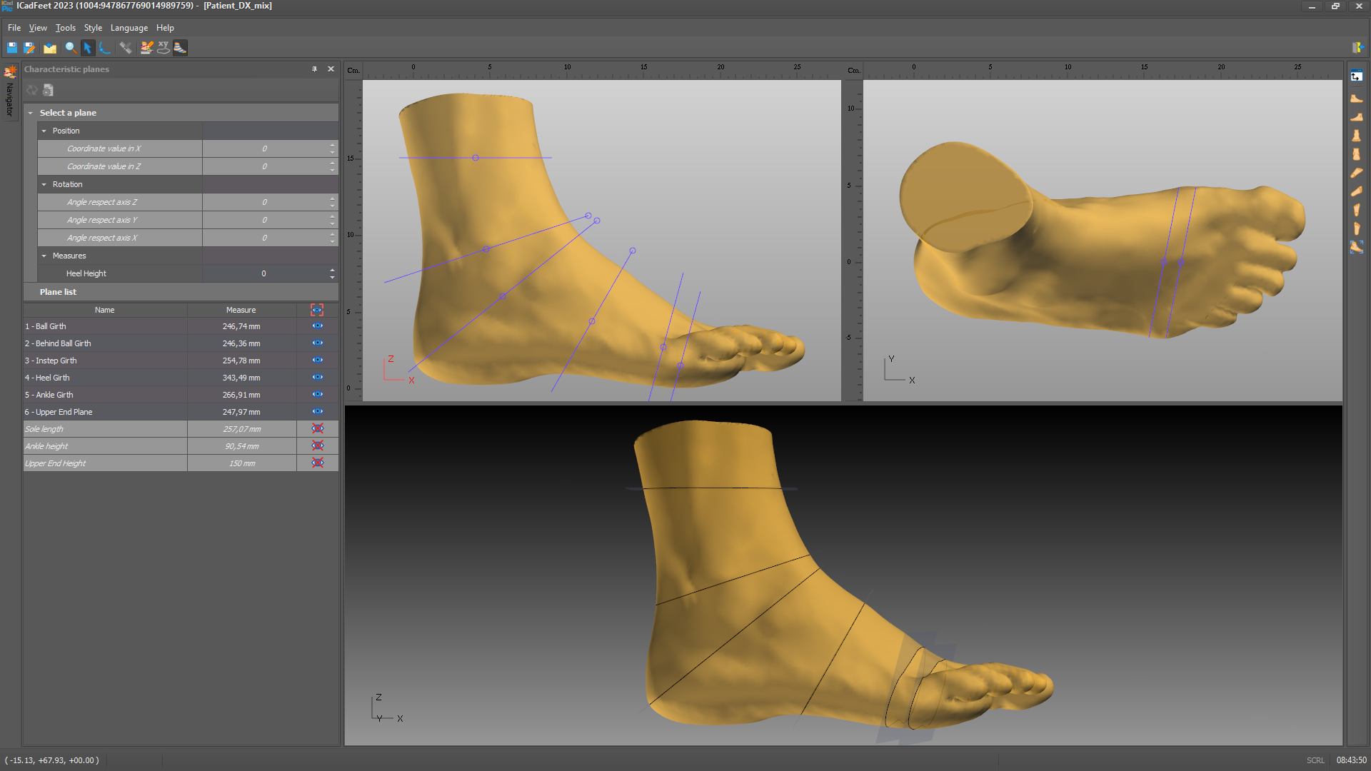Screenshot of 3 scans of a right foot with measurement lines within ICadFeet software.