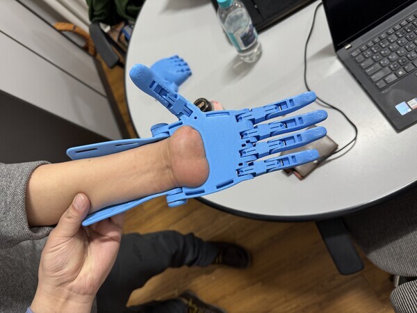 A prosthetic of a hand and forearm