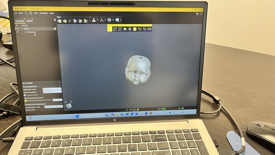 Laptop on a desk displaying the scan of a baby’s head in Peel.OS. 