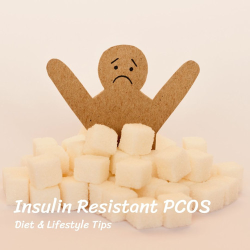 Insulin Resistant PCOS - Diet & Lifestyle Tips 